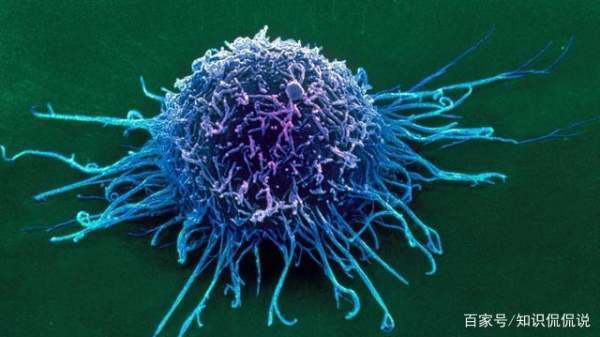 肿瘤切除后会不会复发呢？