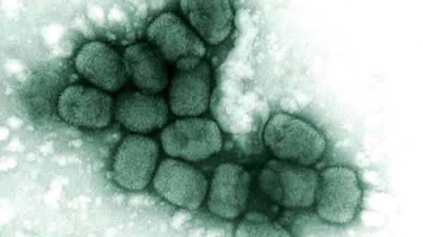 什么是猴痘? 什么是猴痘?