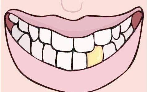 人体最坚硬的部分是： A 牙齿 B 头盖骨 C 指甲