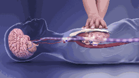 【科普篇】心肺复苏CPR 媚心媚肺明月珰微盘_心肺复苏_心肺脑肺复苏