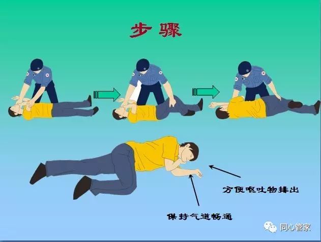 【科普篇】心肺复苏CPR 心肺复苏_媚心媚肺明月珰微盘_心肺脑肺复苏