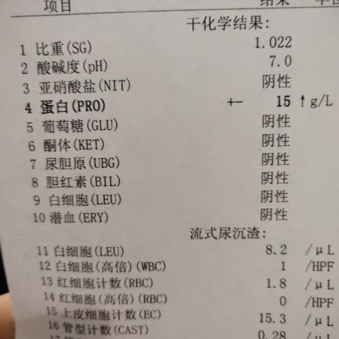 膀胱冲洗怎么记尿量 尿量少尿频是什么原因_尿量_尿量少尿无力是什么原因