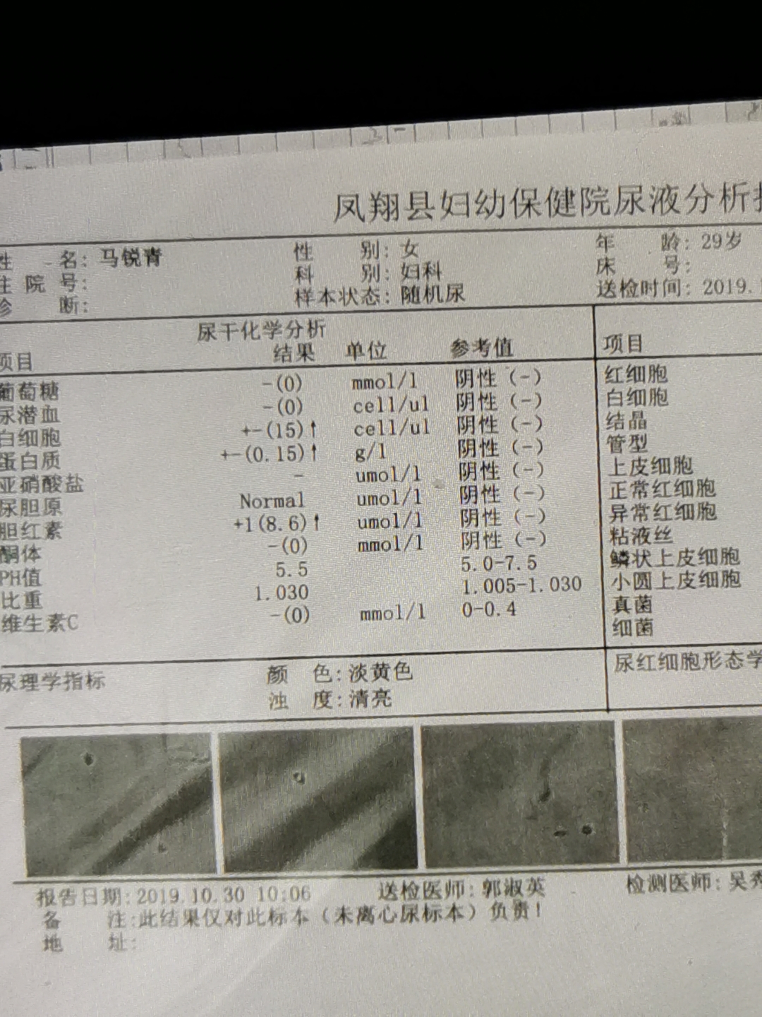 膀胱冲洗怎么记尿量 尿量少尿无力是什么原因_尿量少尿频是什么原因_尿量