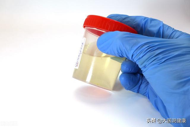 膀胱冲洗怎么记尿量 尿量_尿量少尿无力是什么原因_尿量少尿频是什么原因