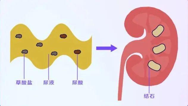 尿量少是什么原因_尿量分级_尿量