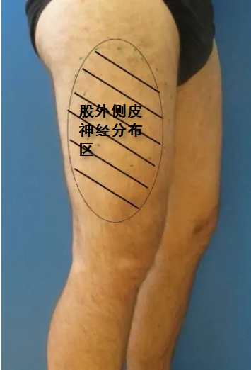 老年病防治/面神经炎